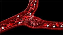 Bluebird Submits BLA for Sickle-Cell Disease Gene Therapy