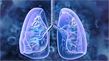 In Group of Firsts, ESMO Highlights Therapeutic Advances in Lung Cancer